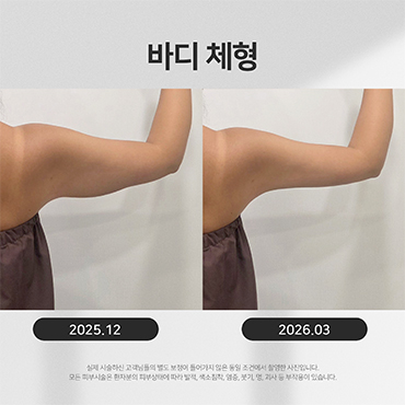 비만/체형 시술전후