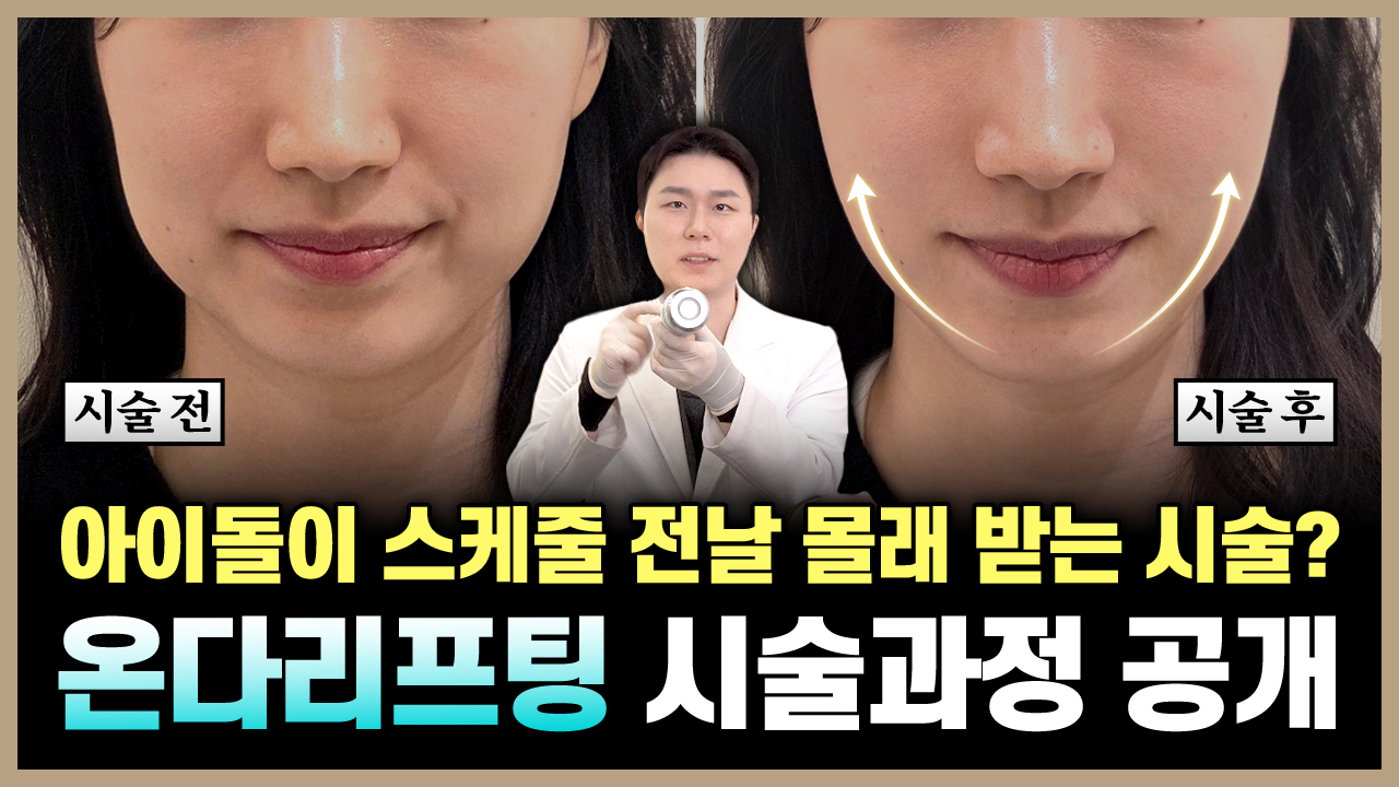 의정부 온다리프팅 얼굴살 리프팅