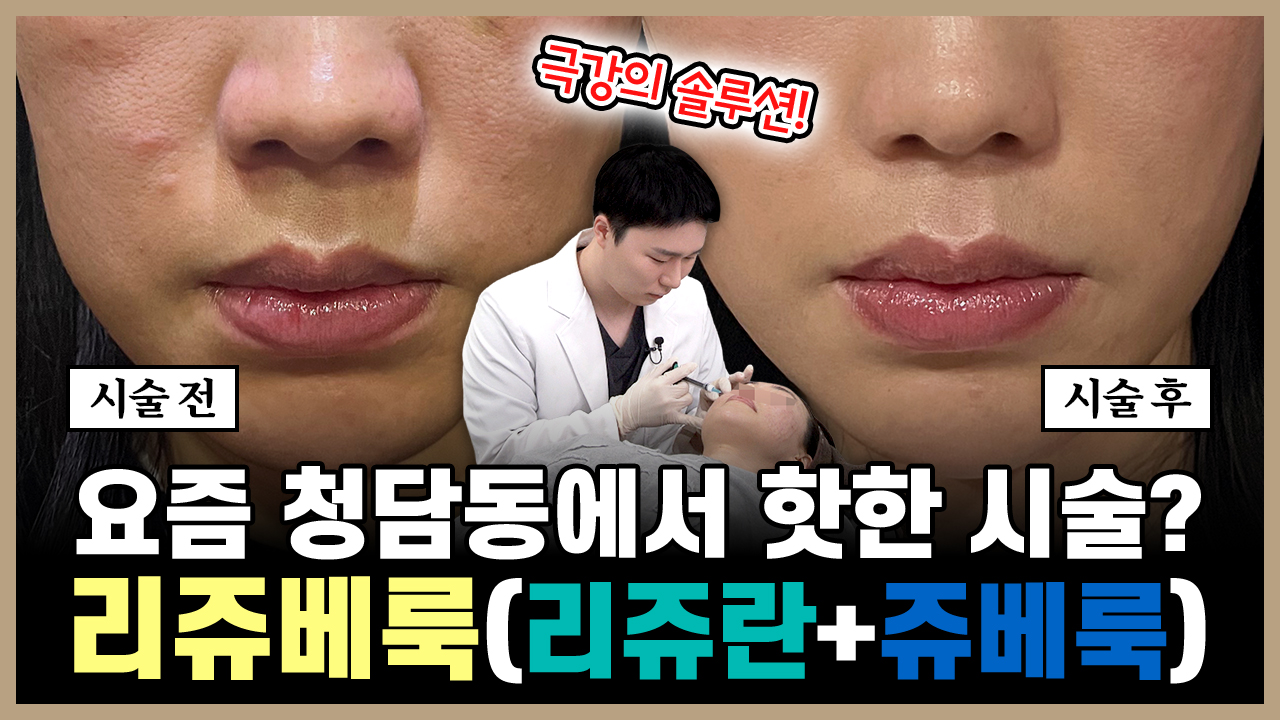 의정부 리쥬베룩 리쥬란 쥬베룩 스킨부스터