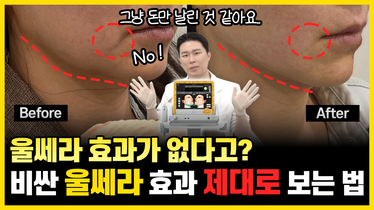 의정부 울쎄라리프팅 효과 제대로 보는 법