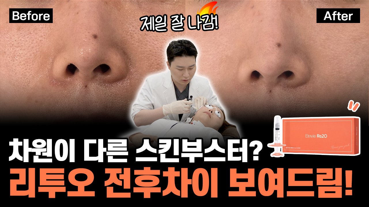 의정부 리투오 엘라비에 스킨부스터