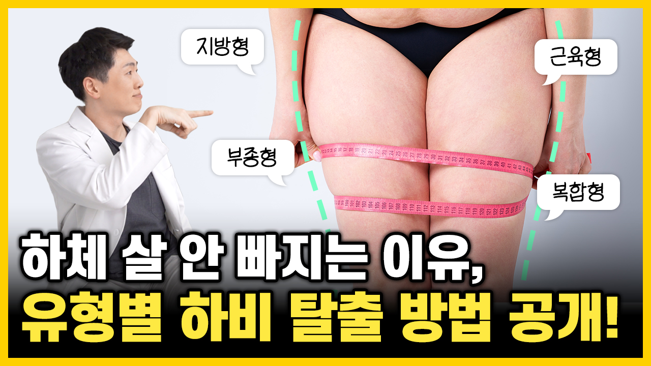 의정부 다이어트 병원 하체비만 유형별 관리